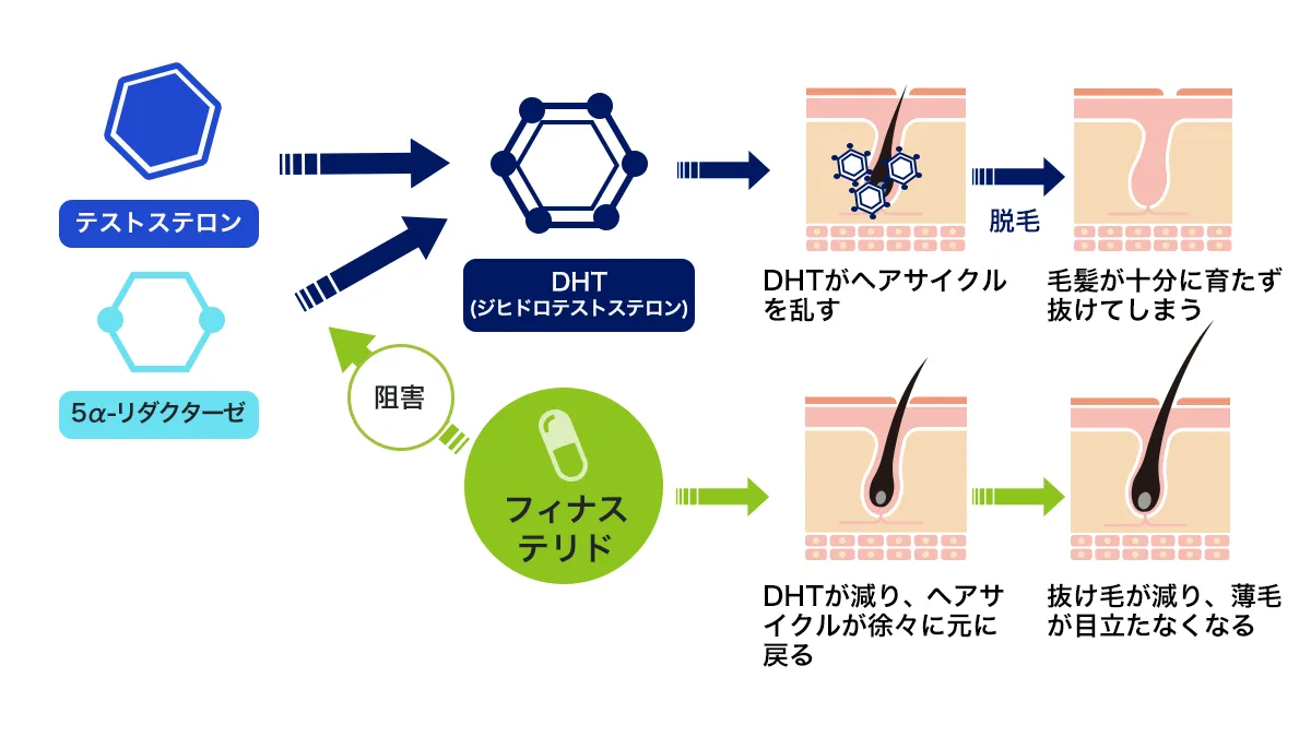 フィナバルドのAGA改善の仕組み