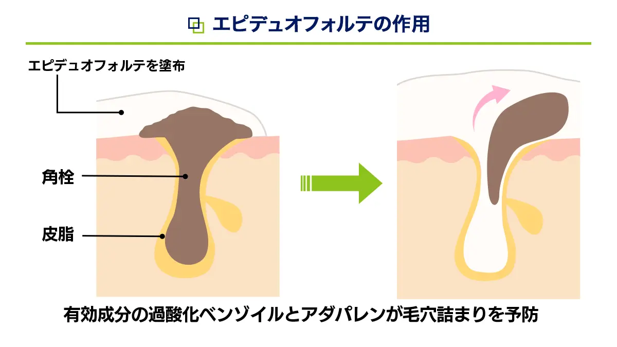 エピュデュオフォルテの作用