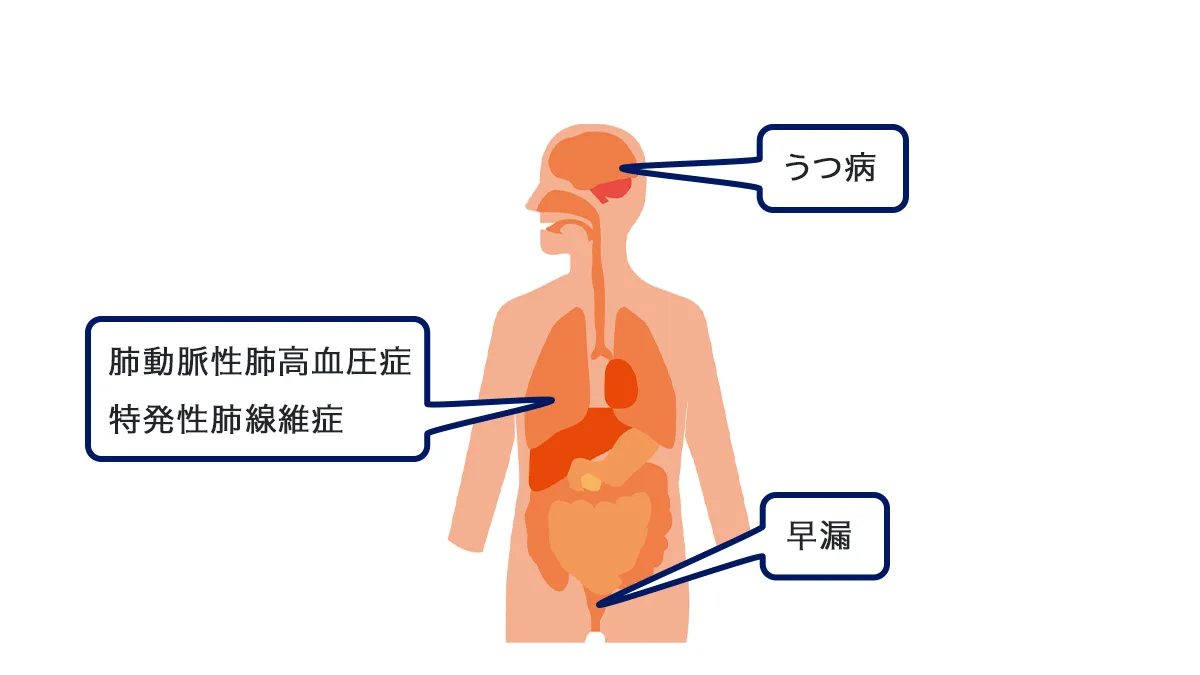 副次的メリット