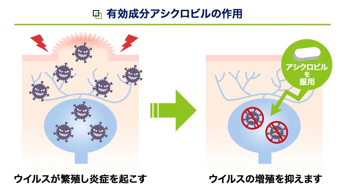 アシビルDTの有効成分