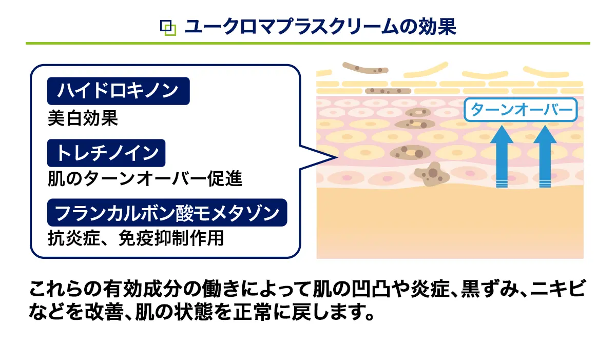ユークロマプラスクリームの効果