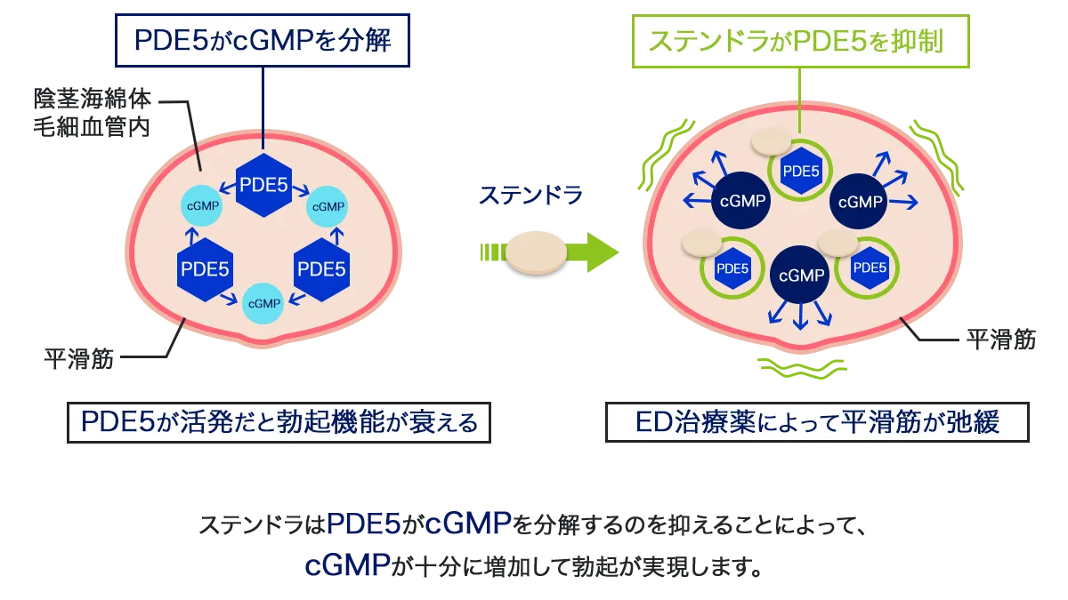 ステンドラの効果
