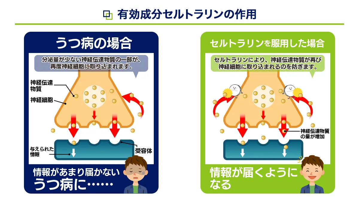 ジェイゾロフトの有効成分