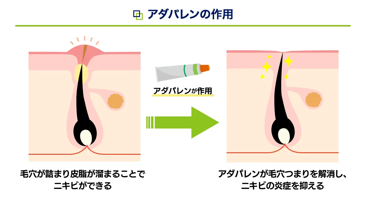 アダフェリンジェルの有効成分