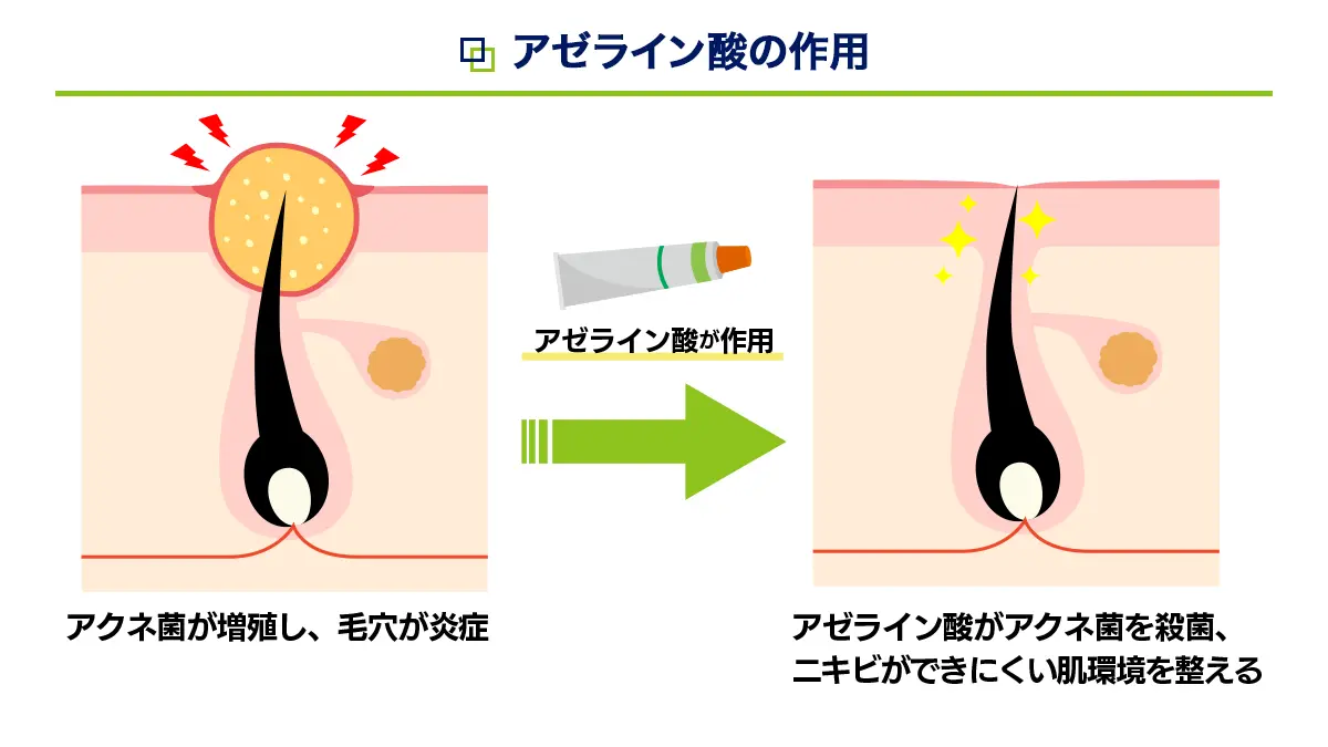 アゼライン酸の作用