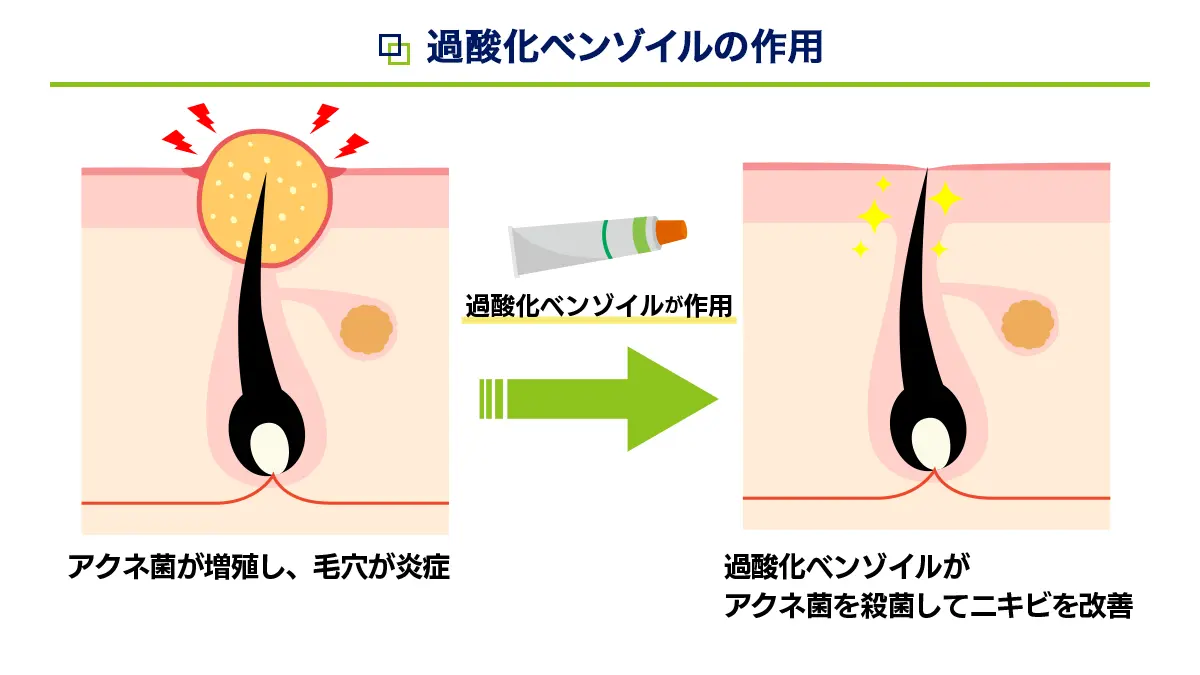 過酸化ベンゾイルの作用