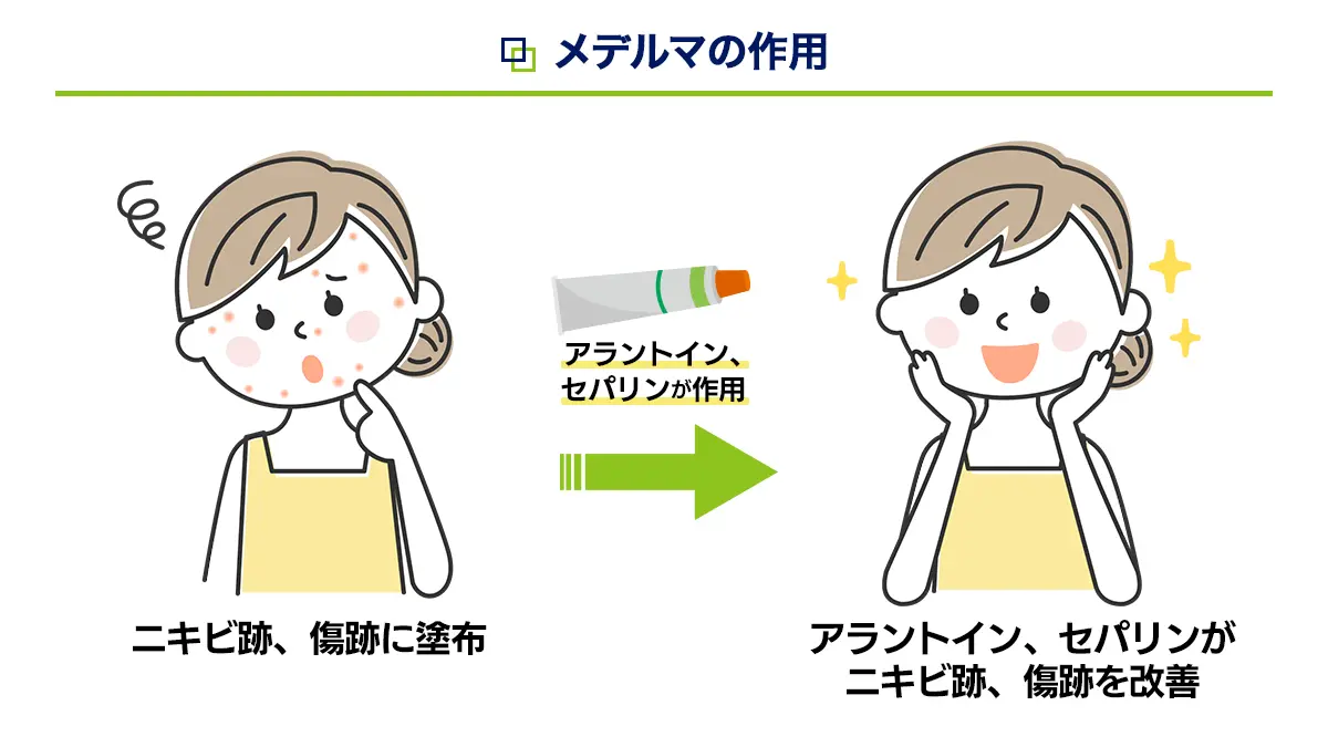 メデルマの作用