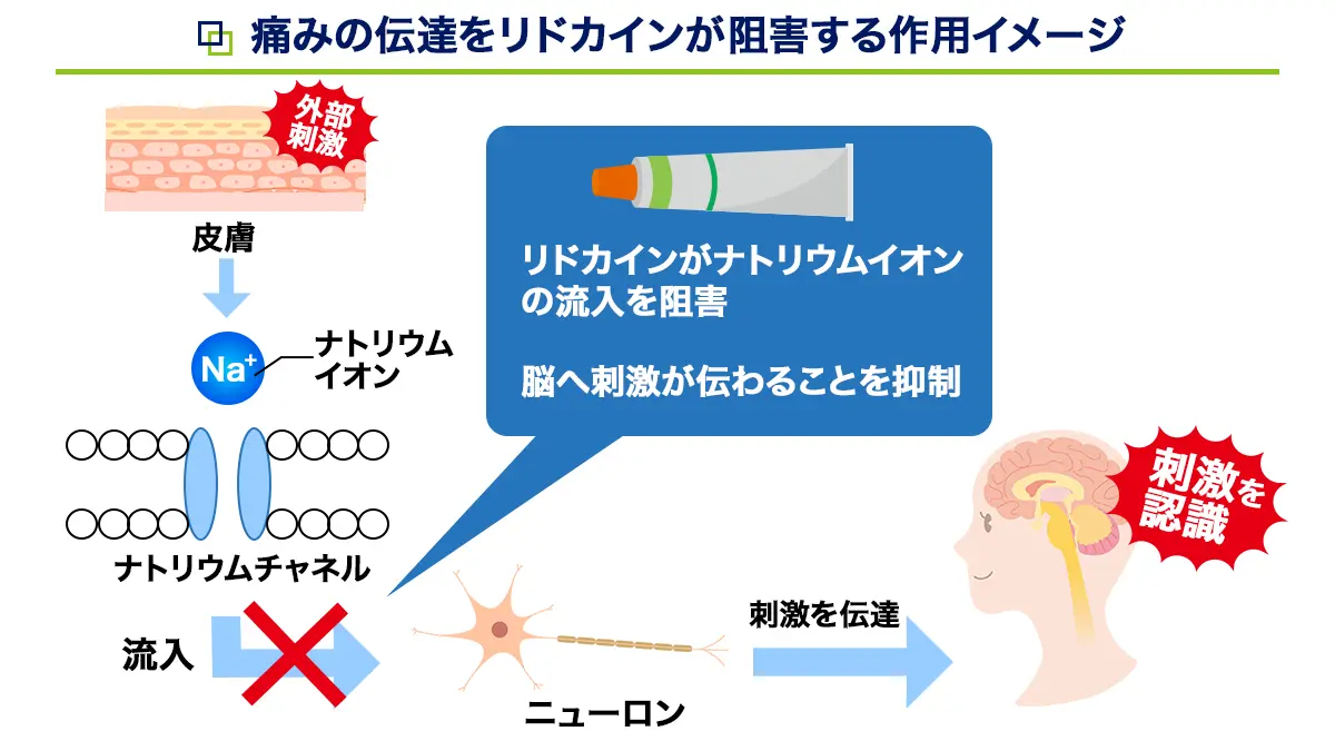 リドカインの作用