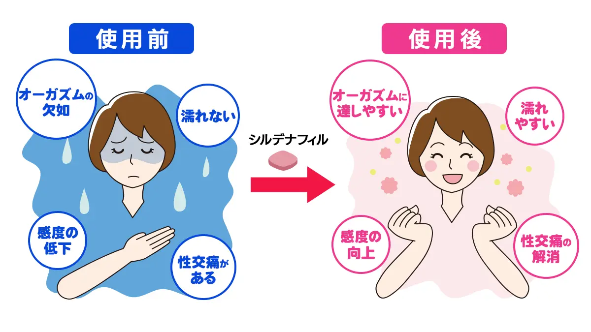 シルデナフィルの臨床試験結果-性的興奮障害